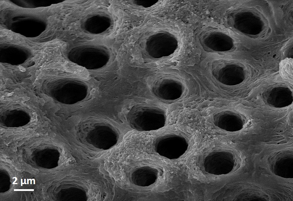 "Morfologia estrutural dos túbulos dentinários de bovinos Grupo de Grupo de Endodontia da Faculdade de Odontologia da UFRGS (PPGODO) Equipamento: MEV Zeiss EVO MA10 "