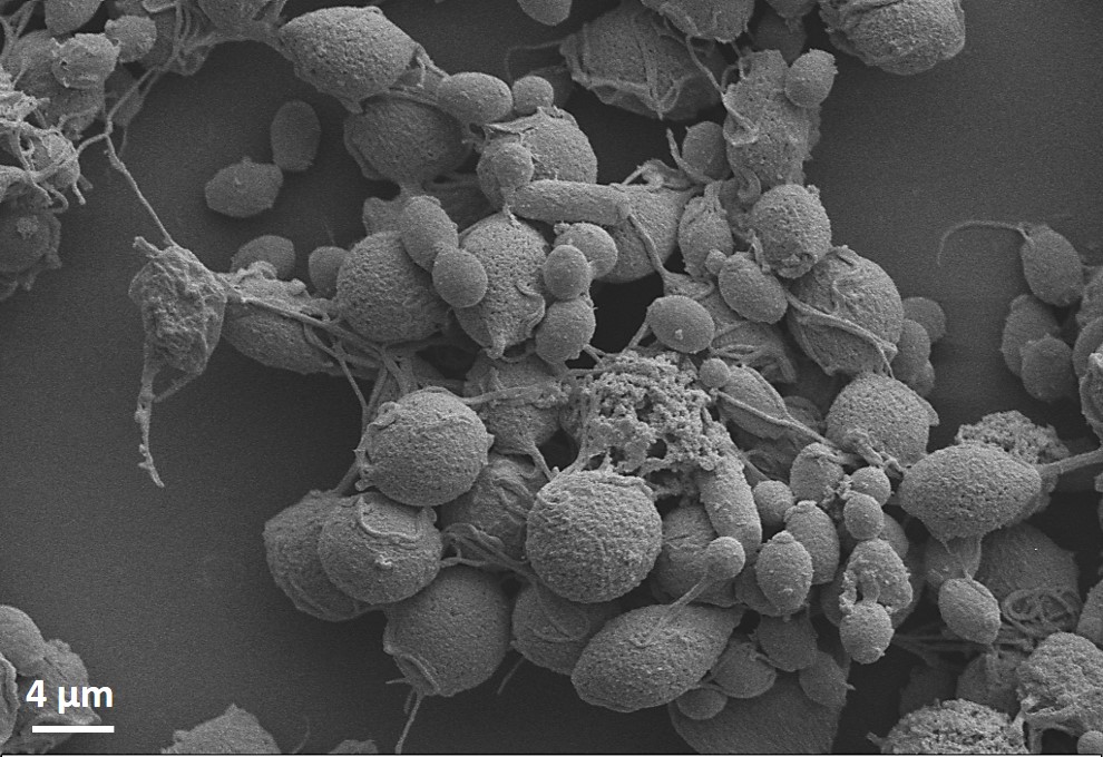 "Co-cultura de Trichomonas vaginalis, Candida albicans e Lactobacillus crispatus Grupo de Pesquisa em Tricomonas (PGTrico) da Faculdade de Farmácia e Centro de Biotecnologia (UFRGS) Equipamento: MEV Zeiss EVO MA10 "