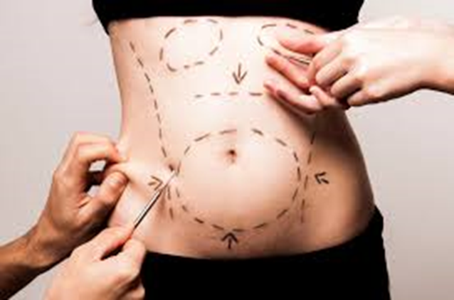 Mulher com a barriga chegia de desejnhos de plástica