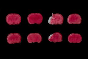 Estudo identifica efeito do lactato para o tratamento de asfixia em recém-nascidos