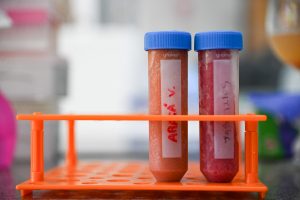 Pesquisa da UFRGS desenvolve bebidas fermentadas com frutas nativas brasileiras