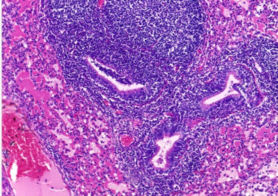 Artigo: Agentes patogênicos de pneumonia em suínos abatidos no sul do Brasil