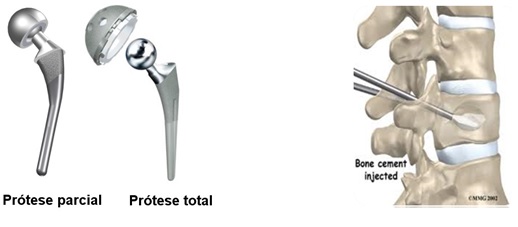 Desenvolvimento de materiais e processos para próteses em implantes
