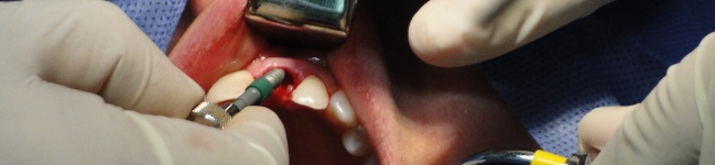 Adesivo odontológico com nanocápsulas de fármacos