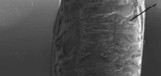 Sistema de eletroforese capilar toroidal