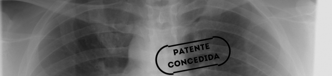 Grampo ortopédico em nitinol memorizado com tratamento termomecânico