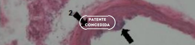 Composições farmacêuticas à base de prosta