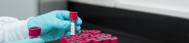 Novo método de teste de deficiência da enzima DPD em tratamento oncológico