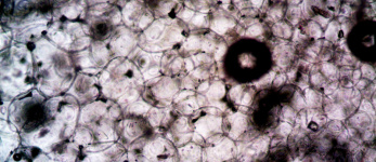 Composição farmacêutica nanométrica na forma de lipossomas ou nanoemulsão que contém sequências específicas de RNA de interferência